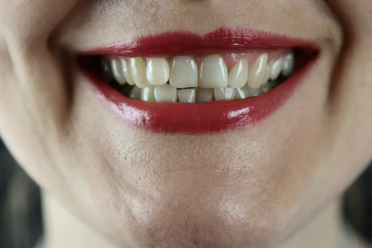 How to Whiten Your Teeth Naturally